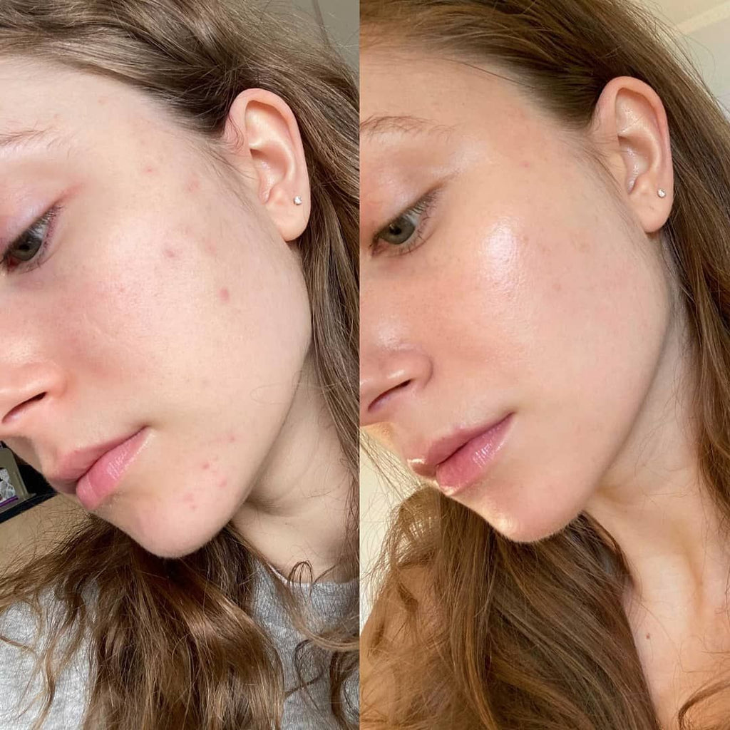 Purelyyou GHK CU Peptide Serum