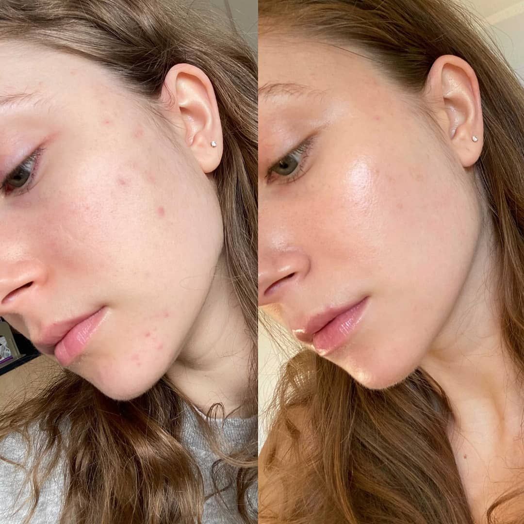 Purelyyou GHK CU Peptide Serum