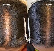 Purelyyou Stimulating Scalp & Hair Balm