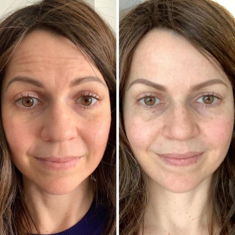 Purelyyou 14 In 1 Magnesium