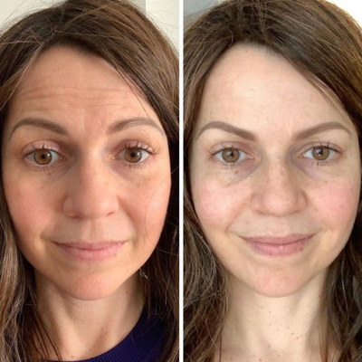 Purelyyou 14 In 1 Magnesium