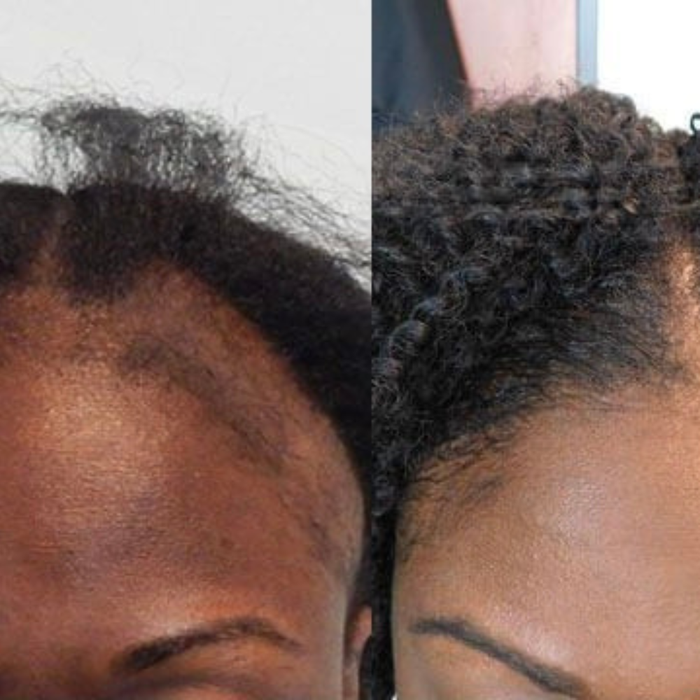 Purelyyou Stimulating Scalp & Hair Balm