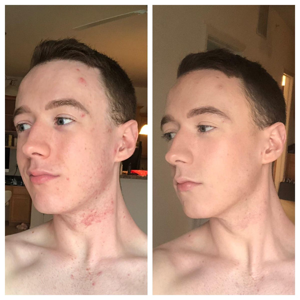 Purelyyou GHK CU Peptide Serum